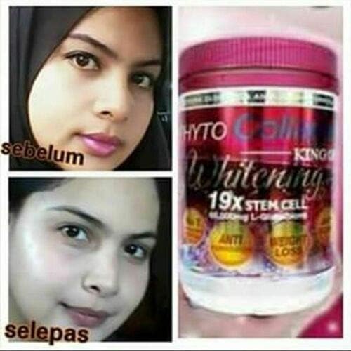 Phyto Collagen Whitening 19X STEM CELL Anti-Aging Pro Whitening Results Energy