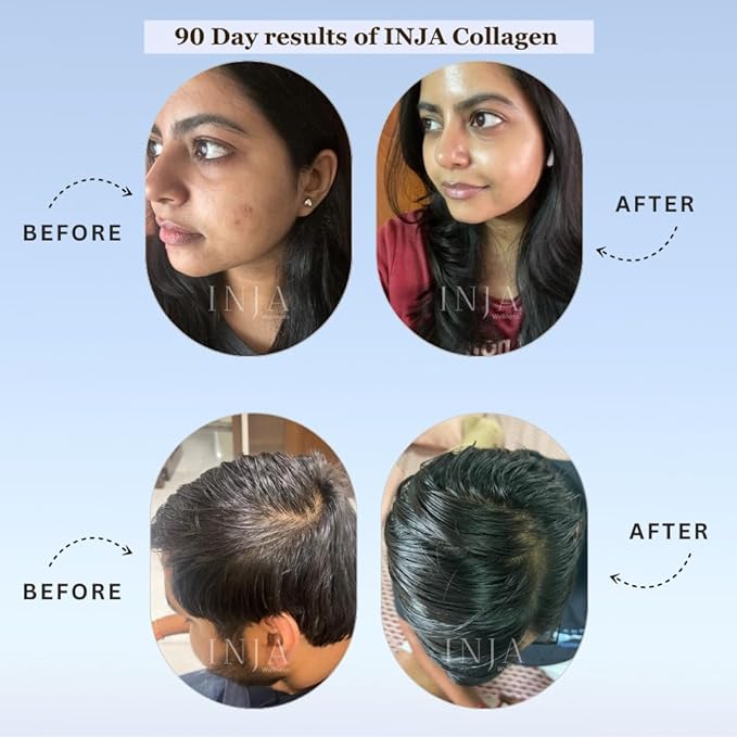 INJA Wellness Beauty Marine Collagen Supplement for Women Men Vitamin C Collagen with Japanese Formulation Healthy Joints Muscles Skin and Hair Sugar and Gluten Free Lychee Flavor 125gm