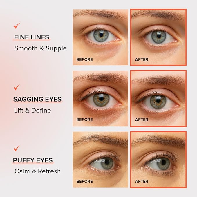 KLAVUU Vegan Collagen Eye Patches for Puffy Eyes &amp Dark Circles (60 Patches) – Hydrogel Under Eye Mask with Niacinamide – Fine Lines Firming Elasticity