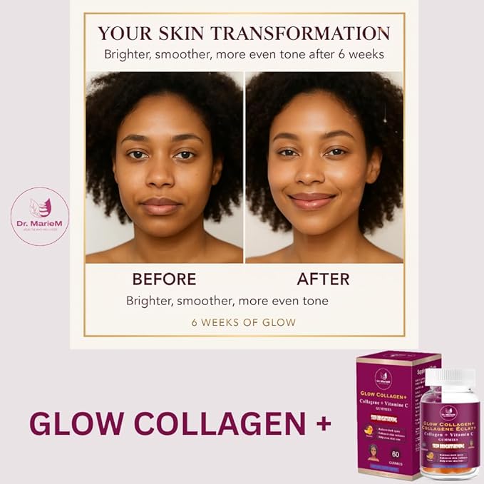 Glow Collagen+ Gummies Supplement – 1000mg Collagen + 500mg Vitamin C for Skin Brightening – Reduces Dark Spots Enhances Radiance and Evens Skin Tone – Tangerine Flavor – 60 Gummies