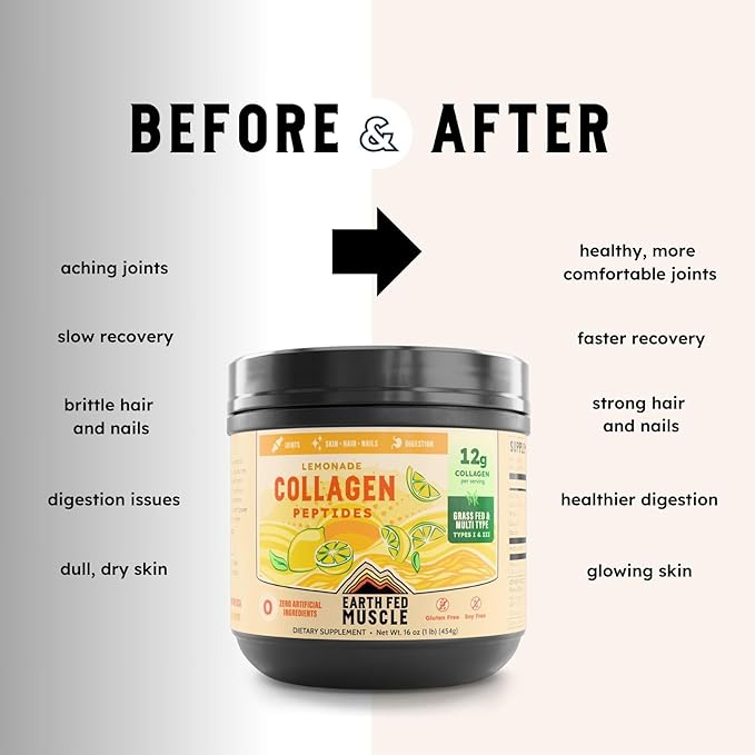 Earth Fed Muscle Lemonade Collagen Powder – Grass Fed Hydrolyzed Collagen for Women &amp Men - Healthy Bones Skin &amp Hair - Types 1 &amp 3 Collagen Powder 12g Per Serving 33 Servings