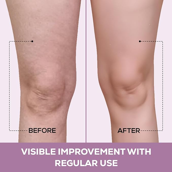 Kami Pure Anti-Wrinkle Knee Pad | Reusable Silicone Gel Anti-Aging Collagen Leg Patch to Repair | silicone wrinkle patches | Hydrate and Smooth Skin best silicone wrinkle patches | Single Pair