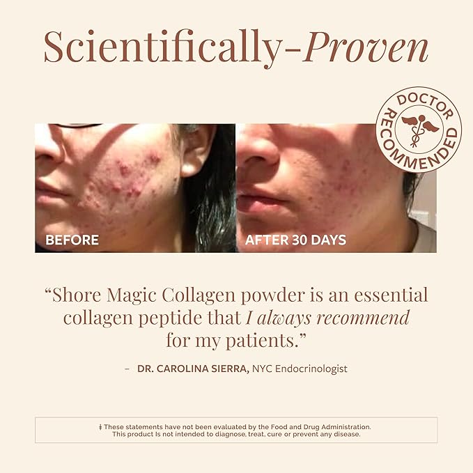 Shore Magic Marine Collagen Powder 14 Servings + Stainless Steel Handheld Milk Frother Bundle