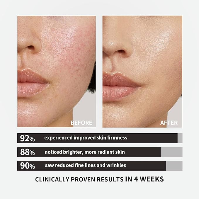 Skin Repair Collagen C Complex | 6500mg Dual-Patented Collagen Powder&amp10 Key Nutrients | 500 Da Micro-Collagen | Supports Skin Hair &amp Nail Texture and Moisture No EstrogenNo Hormones-3.53 o