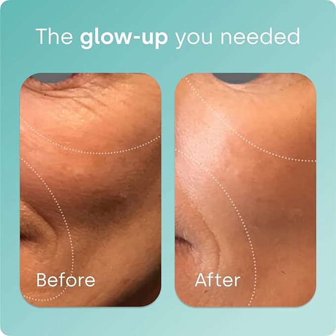 Biosil Collagen Booster Supplement - 60 Original Capsules - Patented ch-OSA Activator for Skin Hair Nails &amp Joints - Supports Natural Production - 30-Day Supply