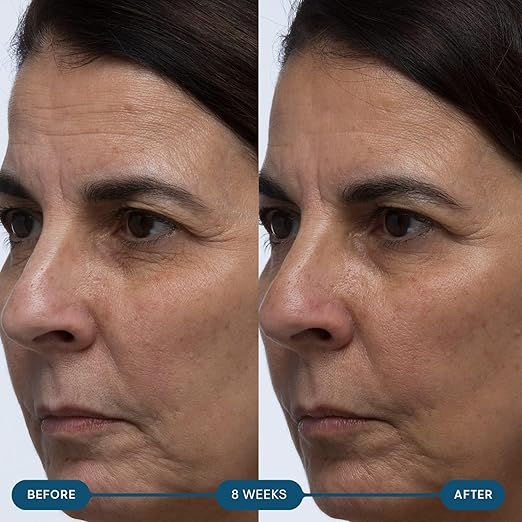 ELEMIS Pro-Collagen Skin Future Supplements Daily Ingestible Reduces the Look of Fine Lines &amp Wrinkles Supports Hydration &amp Elasticity 60 Capsules