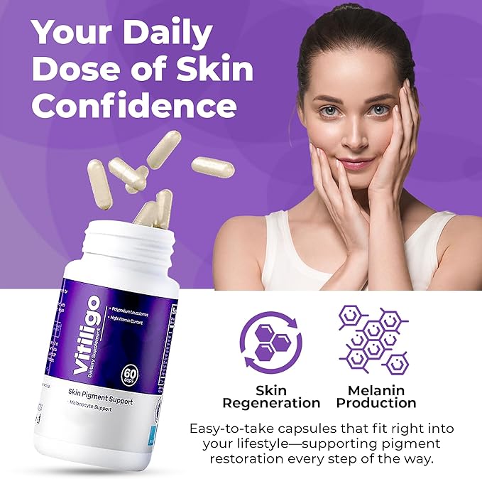 Vitiligo Capsules 60 Count | 1 Month | Improve Skin Pigmentation Support and Reduce White Spots | Effective Vitiligo Supplement | Natural Solution for White Spots on Skin. (2)