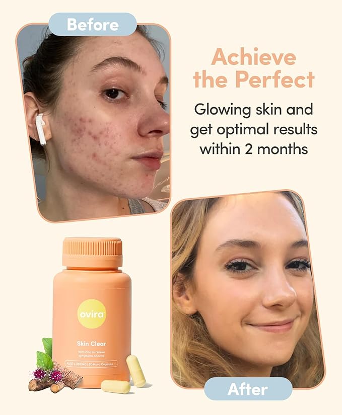 Ovira Skin Clear with ZINCBRIGHT - 60 Capsules for Clear and Glowing Skin | Rosacea &amp Hormonal Acne Treatment | Support Collagen Production | Acne Supplements for Women &amp Men - Pack of 2