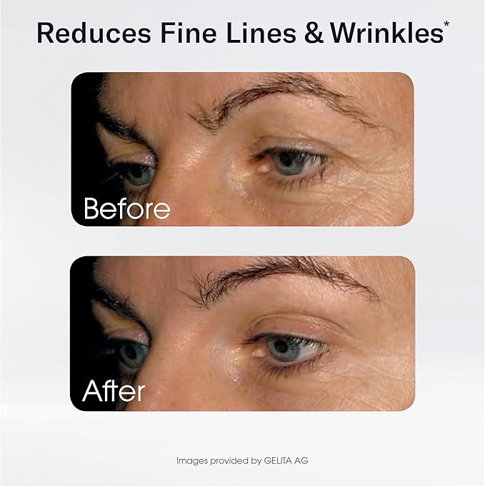 Sparkle Wellness Skin Boost Collagen Capsules (180 Pills) | 30 Days of 2500mg VERISOL Collagen Peptides &amp Vitamin C | Improves Skin Elasticity &amp Appearance of Fine Lines | Strengthens Hair &am