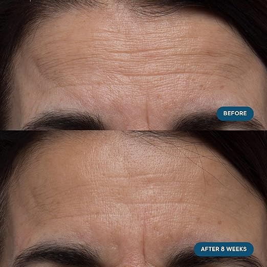 ELEMIS Pro-Collagen Skin Future Supplements Daily Ingestible Reduces the Look of Fine Lines &amp Wrinkles Supports Hydration &amp Elasticity 60 Capsules
