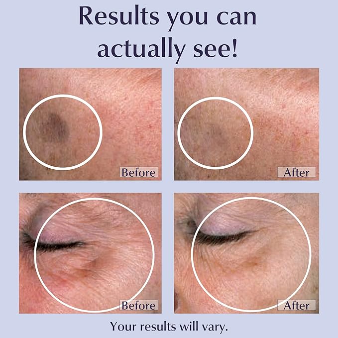Lane Innovative - Toki Powder Collagen Supplement for Skin Collagen Peptides for Anti-Aging Anti-Wrinkle Formula Helps Reduce Age Spots Peptides for Youthful Skin (30 Servings)