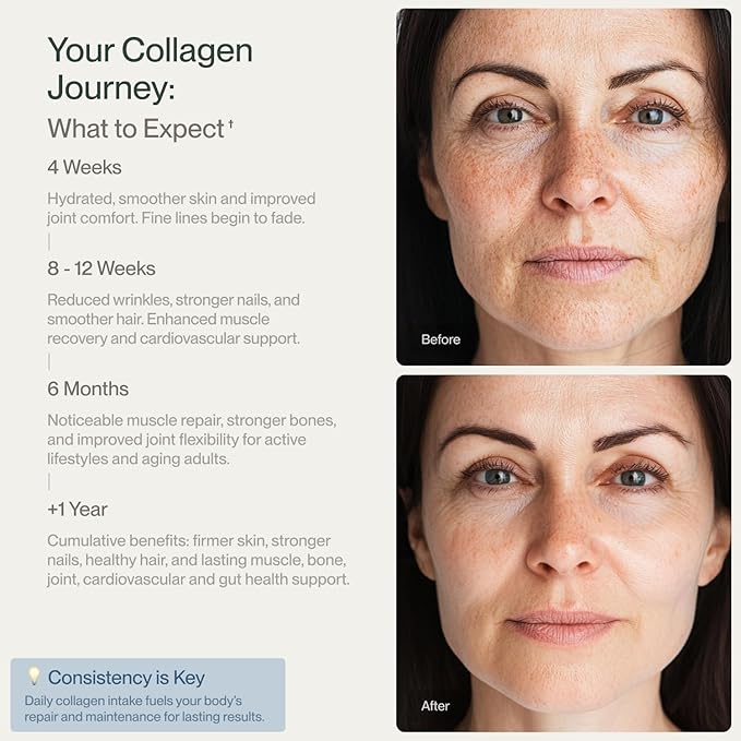 Collagen Peptides Powder Grass-Fed Pasture-Raised Hydrolyzed Collagen Powder Type I &amp III Hair Nails Skin and Joints Non-GMO Paleo &amp Keto Unflavored 16 Fl oz. 2 Pack 45 Servings