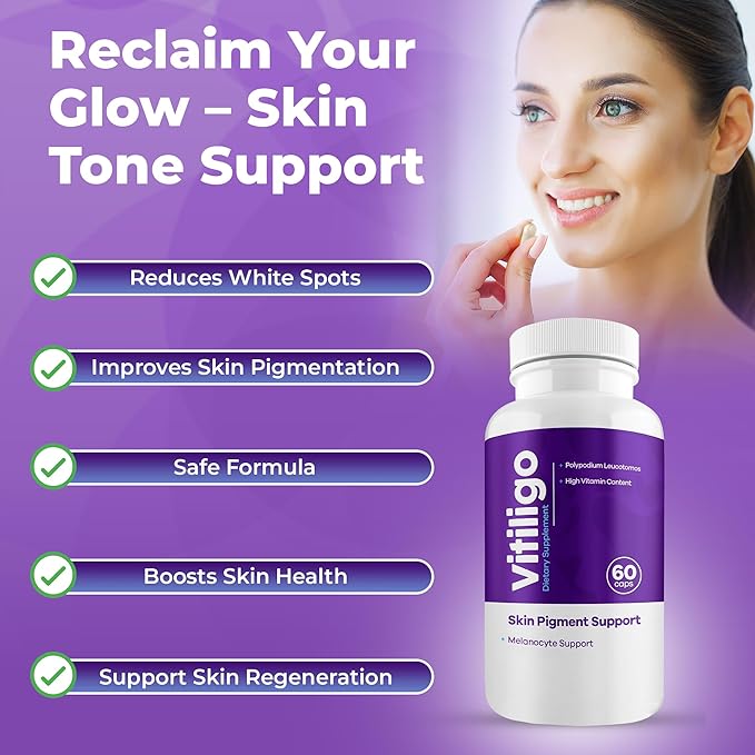 Vitiligo Capsules 60 Count | 1 Month | Improve Skin Pigmentation Support and Reduce White Spots | Effective Vitiligo Supplement | Natural Solution for White Spots on Skin. (3)