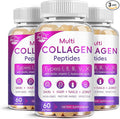 Multi Collagen Peptides Softgel - Type I II III V X - Hydrolyzed Collagen Peptides with Biotin Vitamin C Hyaluronic Acid Supports Skin Hair Nail Grass-Fed Non-GMO 60 Softgel 3 Pack