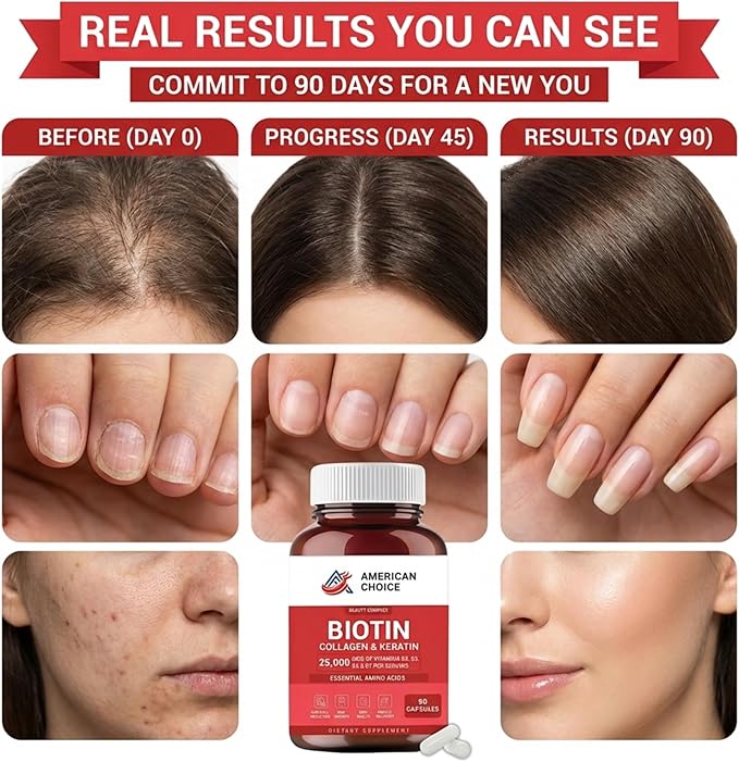 Biotin Collagen Keratin Hair Vitamins Women and Men Biotin for Hair Growth Women Skin and Nails Supplement 25000 mcg with B Vitamins Amino Acids and Minerals Skin and Nail Health 90 Capsules