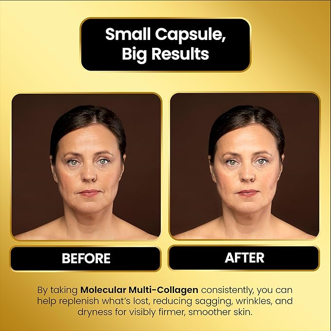 Cocó March N.M.D. Molecular Multi-Collagen - Types I II III V &amp X – Hair Skin Nails &amp Joint Support for Women &amp Men – Low Molecular Weight Collagen Gluten Free Dairy Free Soy Free