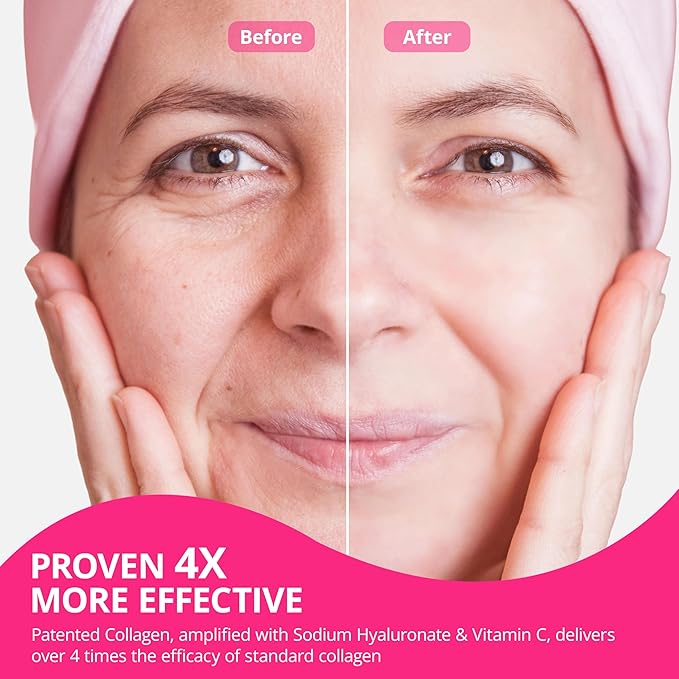 Collagen Powder for Women Collagen Peptides Powder with Probiotics Prebiotic Collagen Protein for Skin Hair Bone &amp Joint | 16-in-1 Sugar-Free Formula Unflavored