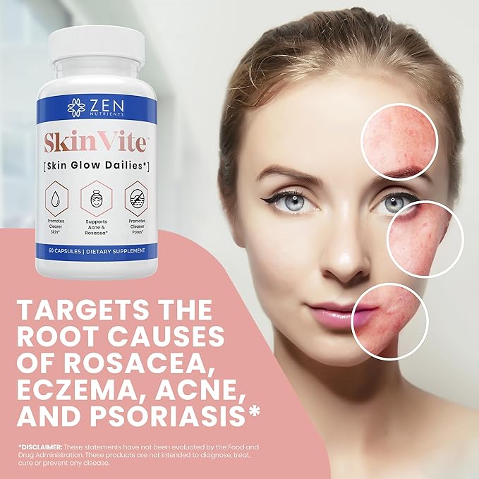 Zen Nutrients SkinVite Natural Skin Supplement for Women Men &amp Teens - Hormonal Breakouts &amp Clear Skin Support Supplement - Detoxifying Vitamin for Acne and Digestion Support