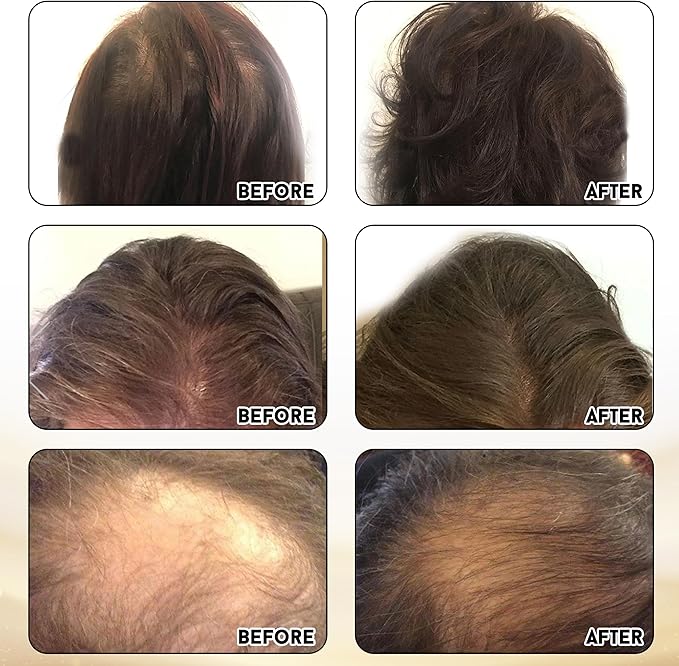 Joyce Giraud Ultimate Hair Strength Supplements 90-Day Supply Scientifically Formulated to Reduce Hair Loss 180 Capsules