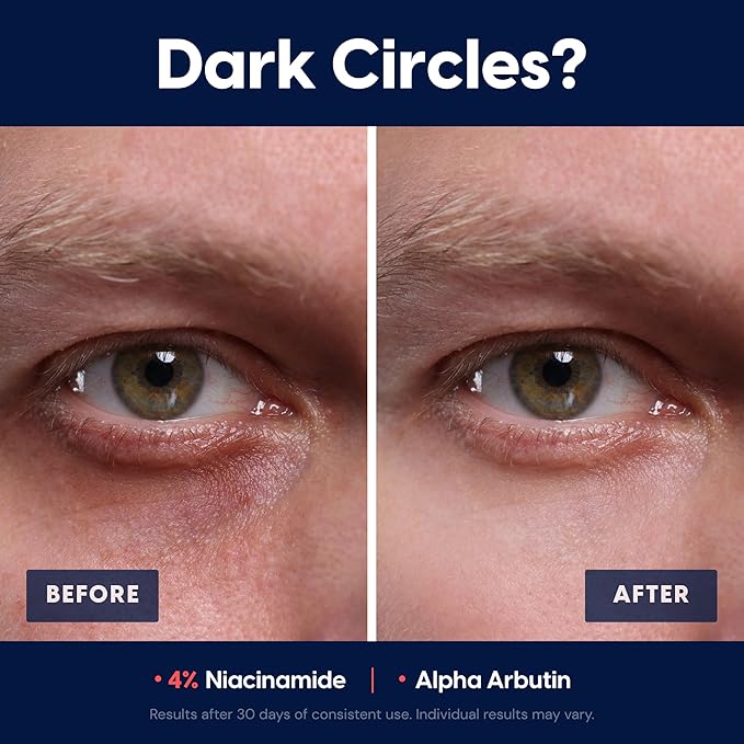 Strive Apex Skin Care Set - Advanced Anti Aging - Fragrance Free All Skin Types Fights Dark Circles Dull Skin - Peptides Retinal Vitamin C Niacinamide (Face Wash Scrub Moisturizer Serum)