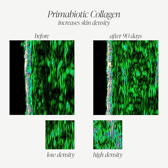PRIMABIOTIC Liquid Collagen - High Collagen Content [10000 Mg] Per Serving - Hydrolyzed Collagen and 12 Vitamins - Gluten Free- 900 Ml - Pack of 30 Bottles x 30 Ml (1)
