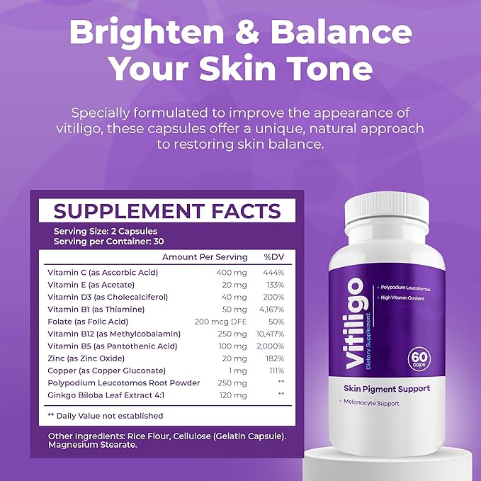 Vitiligo Capsules 60 Count | 1 Month | Improve Skin Pigmentation Support and Reduce White Spots | Effective Vitiligo Supplement | Natural Solution for White Spots on Skin. (3)