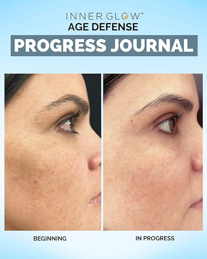 Age Defense Vitamins - Dermatologist and Plastic Surgeon Developed to Fight photoaging and Melasma Polypodium Leucotomos Antioxidant Formula – Vegan Gluten-Free – 60 Capsules