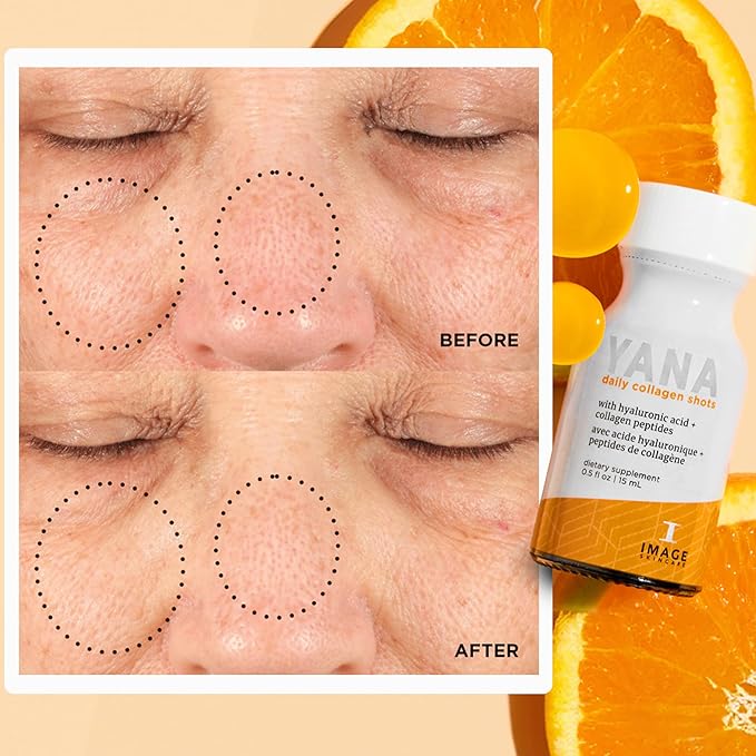 IMAGE Skincare YANA Liquid Collagen Shots 2500 mg Hydrolyzed Bovine Collagen Peptide Supplement with Biotin Natural Citrus Flavor 28 Daily Shots